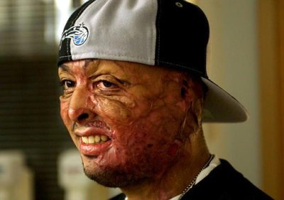 Jos� Martinez - US serviceman wounded in Iraq