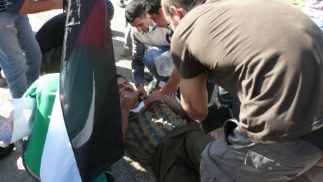 This activist sustained a shoulder injury from a gun fire tear gas canister